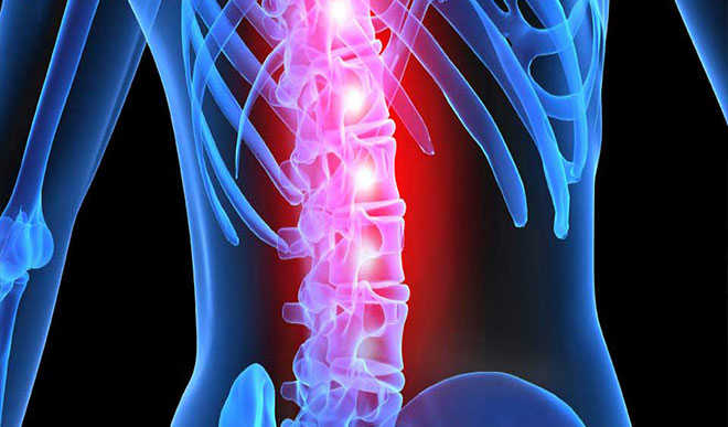 How to handle spinal cord injury? - Daily Trust