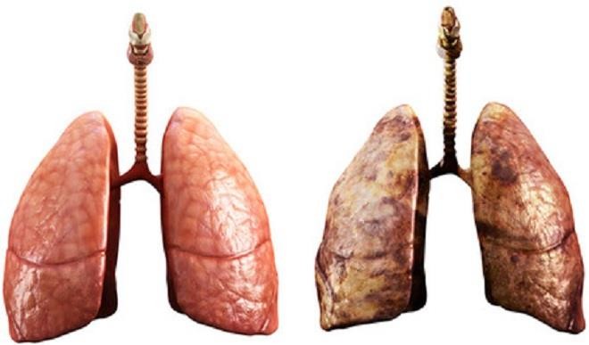 My brother’s lungs have failed - Daily Trust