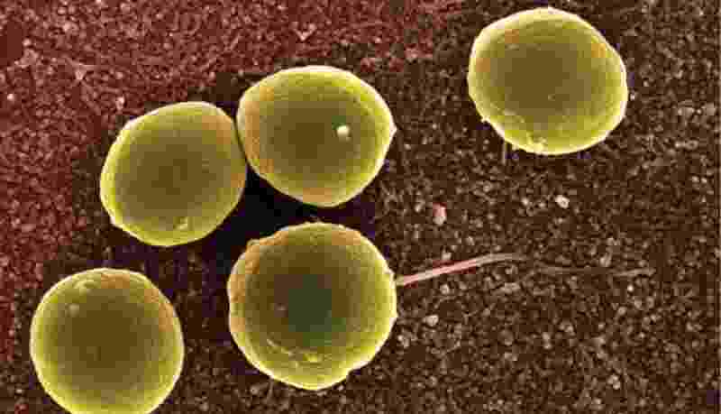 Staphylococcus: From Harmless Skin Bacteria to Deadly Pathogen