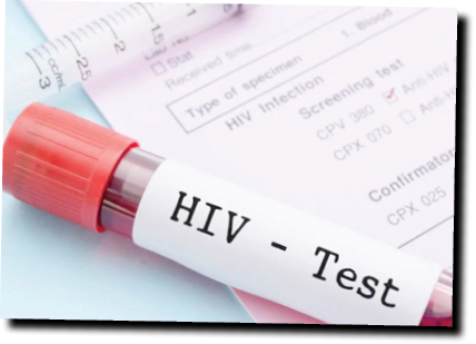 FG approves new HIV rapid test kit