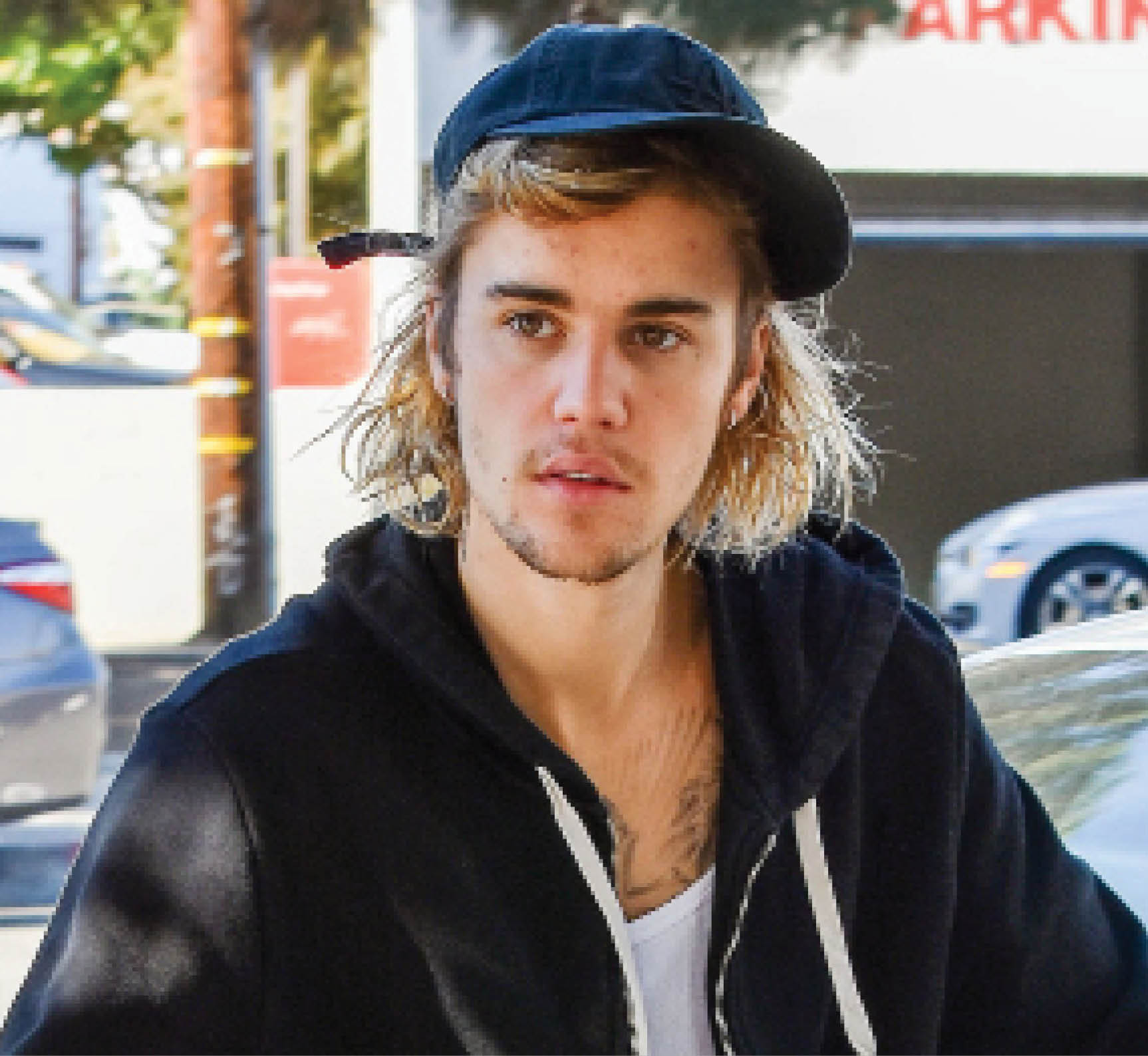 Justin Bieber suffers partial facial paralysis due to Ramsay Hunt syndrome