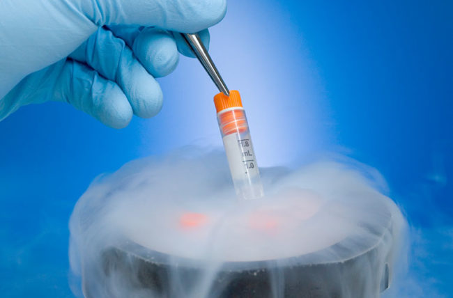 What you should know about infertility and freezing your eggs