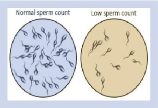 How Lifestyle Choices Affect Mens Sperm Count Daily Tru 8704