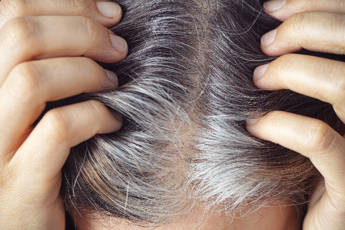 Stress can turn hair grey – and it’s reversible, researchers find