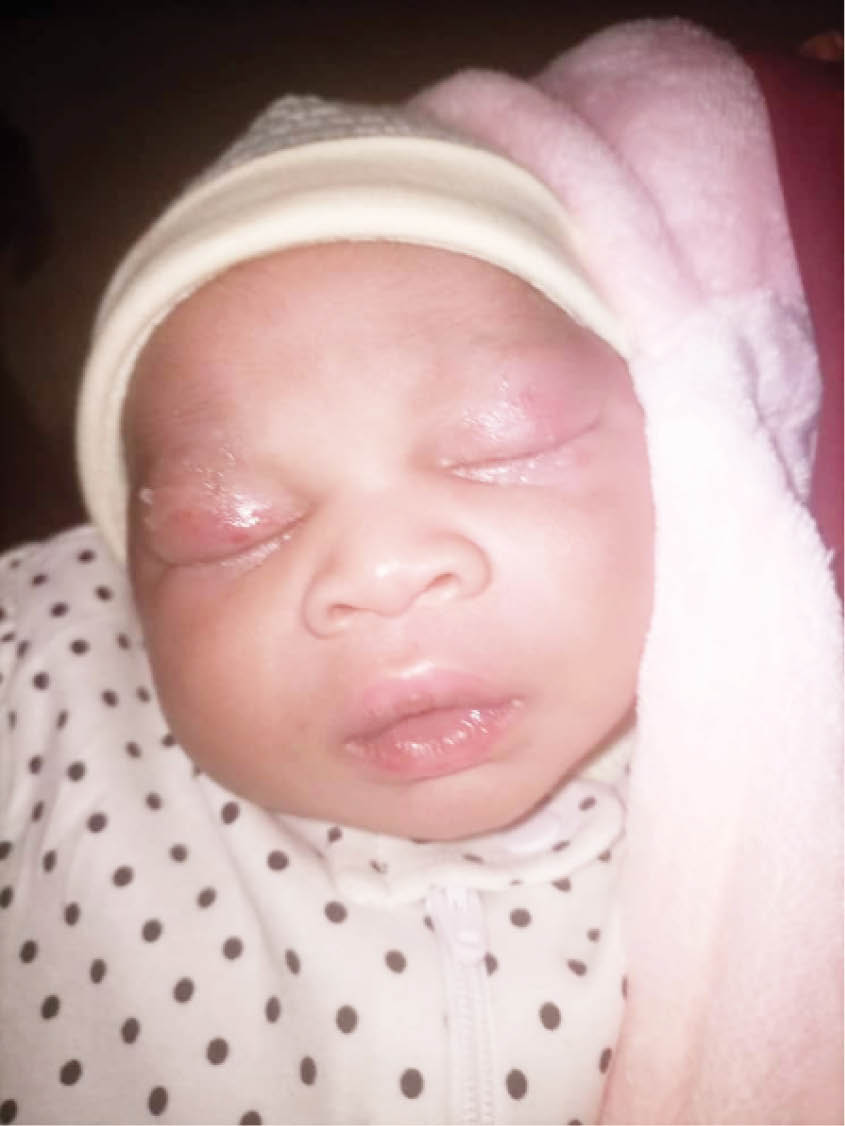 After Daily Trust story, UDUTH suspends nurse that ‘pierced newborn baby’s eye’ indefinitely