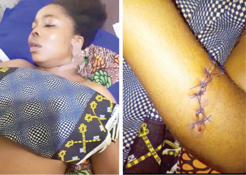 Benue nurse stabbed on duty seeks help