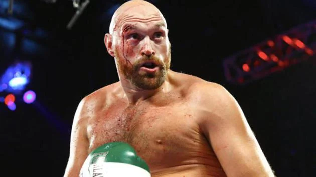 Tyson Fury: I’d Be Very Sad and lonely after retiring from boxing