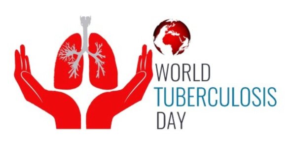 Kaduna records 32,297 tuberculosis cases
