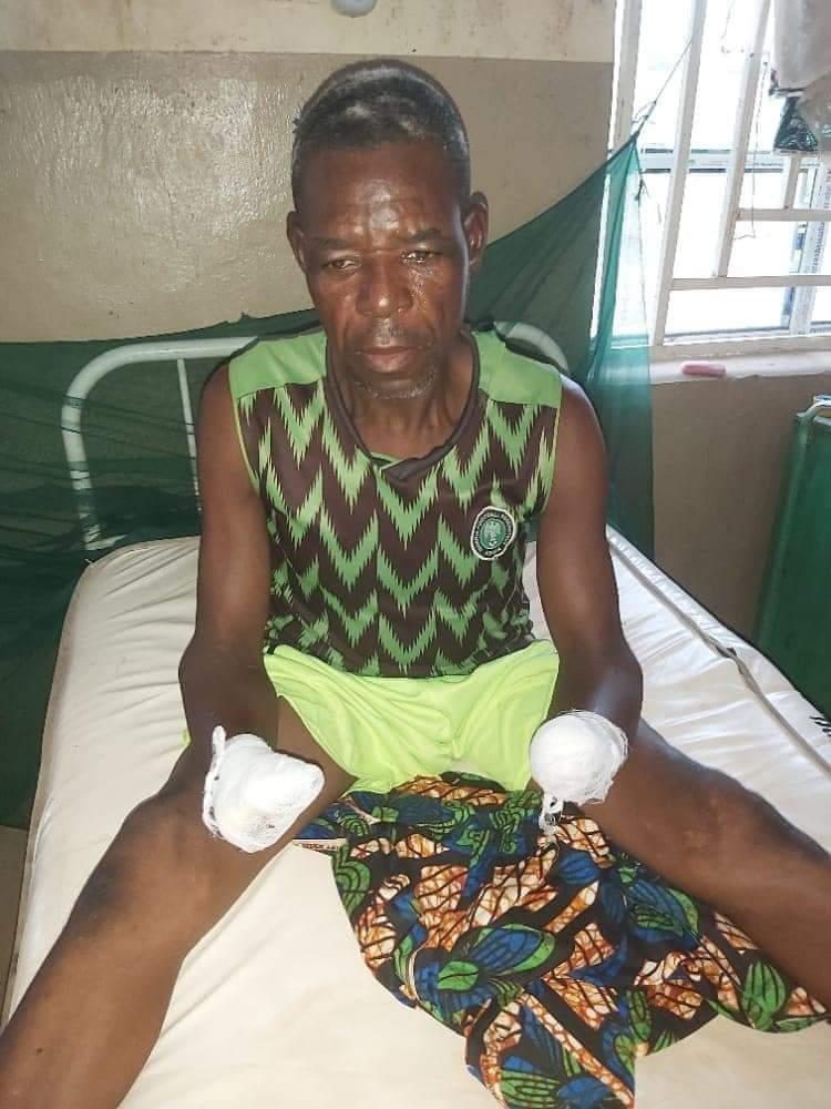 Bandits chop off man’s hands in Zamfara