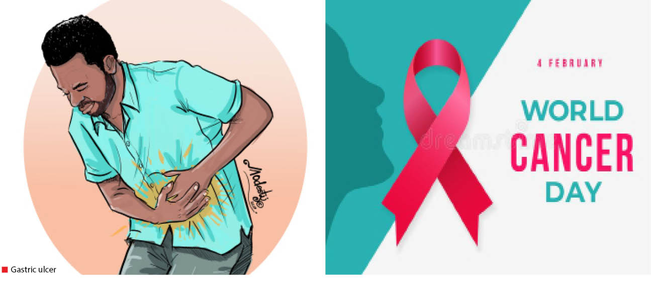 World Cancer Day: Closing the gap in cancer care in Nigeria