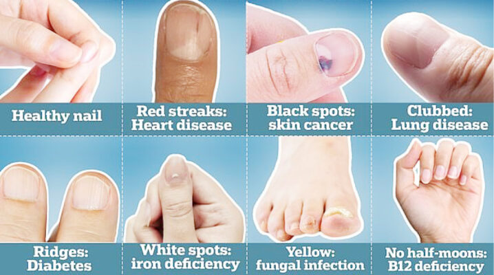 What Does the Color of Your Nails Say About Your Health? - wide 9