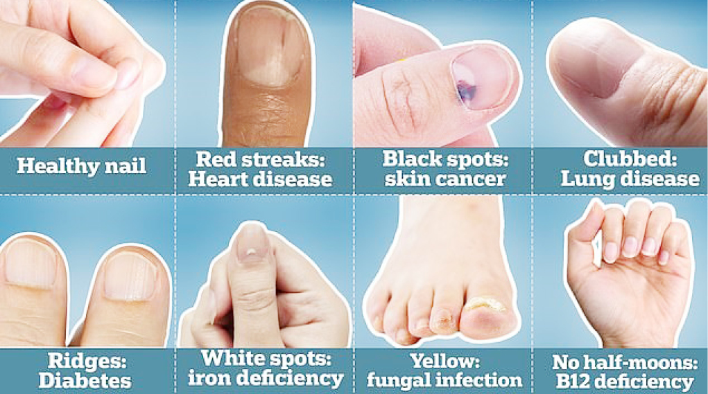 The 4 Most Common Causes of Black Toenails Foot Healthcare Associates