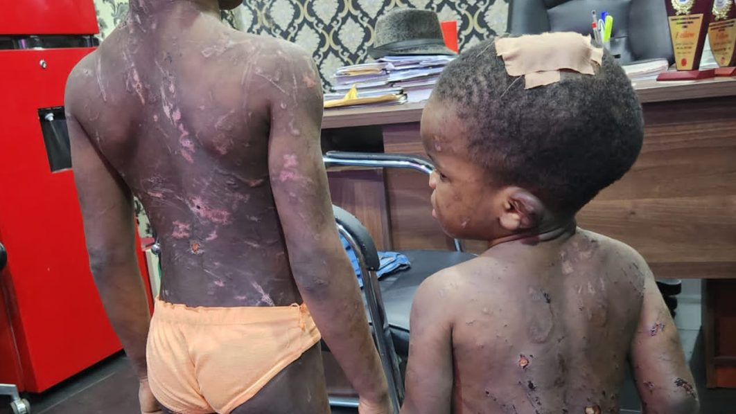 NIGERIA DAILY: How People Abuse Children Physically