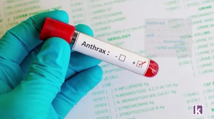 Nigeria confirms first anthrax case