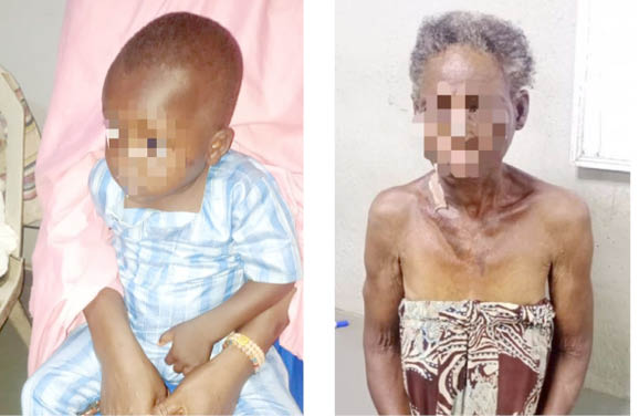 Mob attacks 70-year-old woman found with stolen 2-year-old baby in Lagos