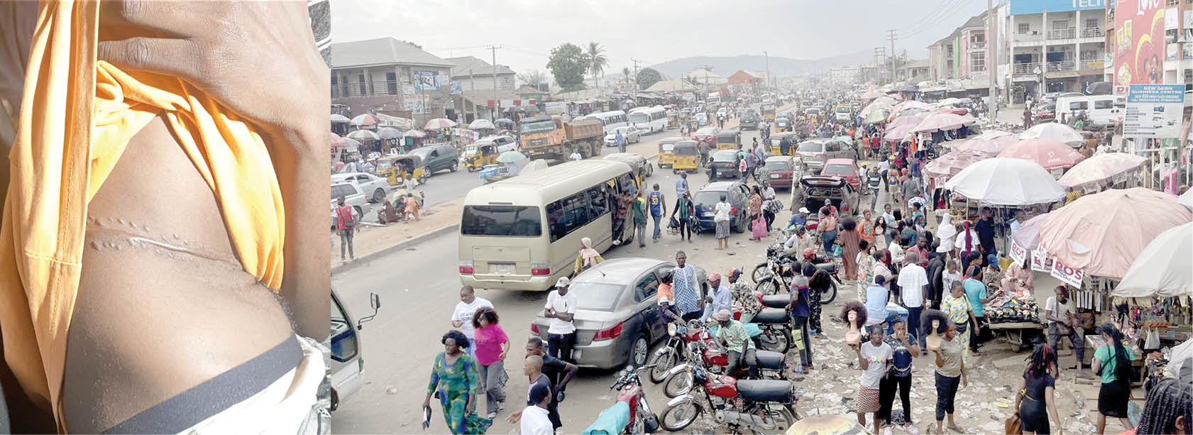 Investigation: Inside Abuja’s Kidney ‘Market’ Where The Rich Prey On The Poor