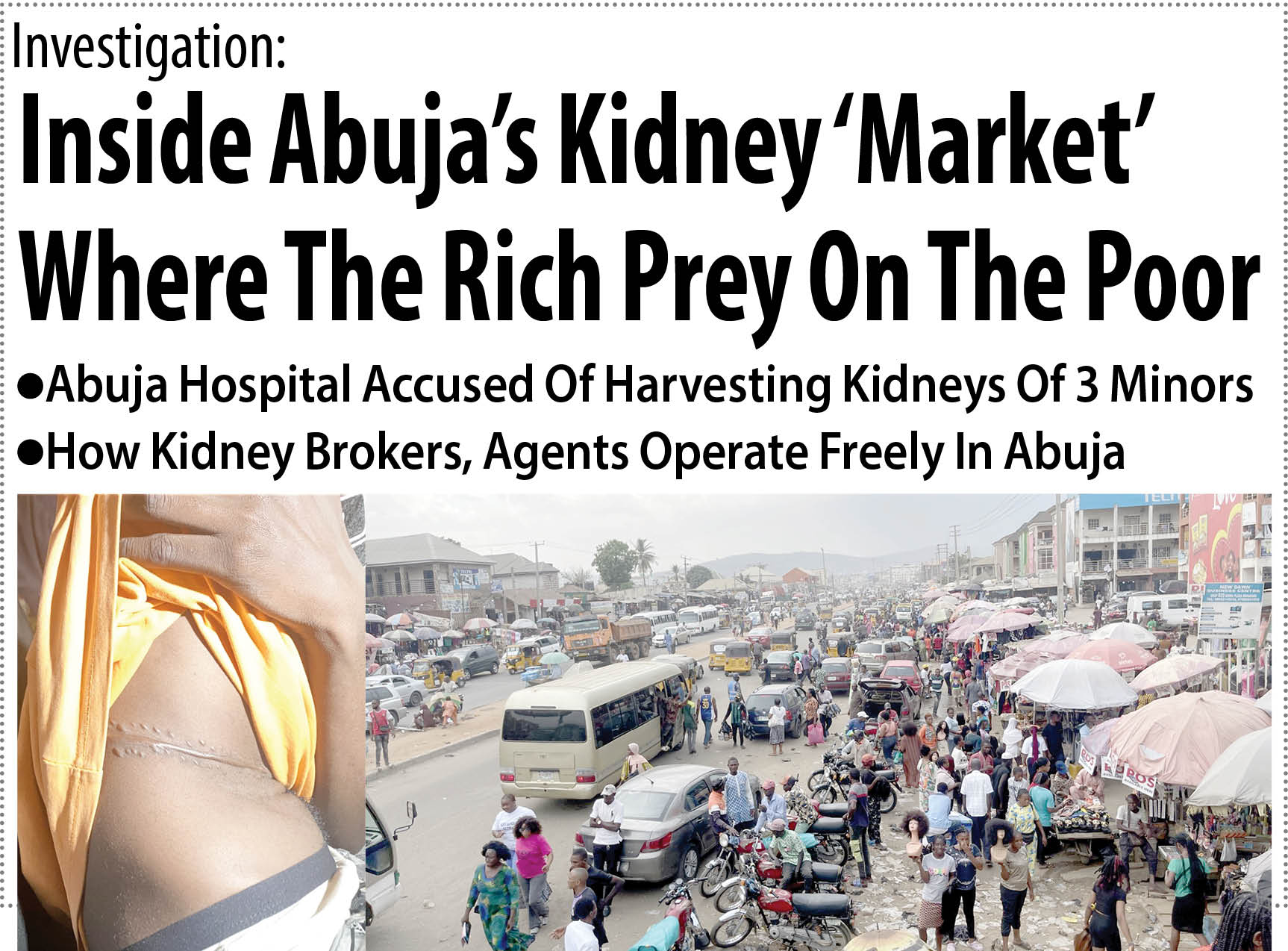 After Daily Trust’s report, FG goes after kidney traders