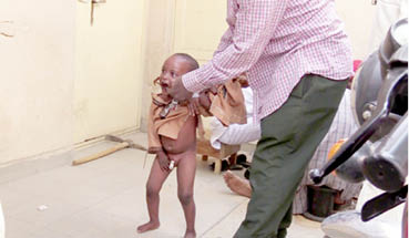 Mass circumcision: How Kano lawmaker is reviving age-long tradition