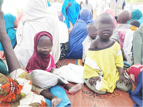 Parents helpless as malnutrition ravages 7 northern states